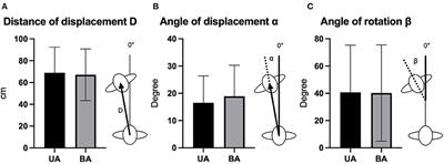 Influence of Hearing Rehabilitation With Active Middle Ear and Bone Conduction Implants on Postural Control